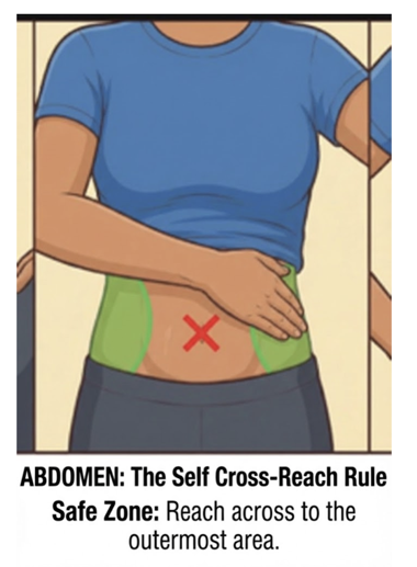 Abdominal insulin injection area showing rotation away from the navel